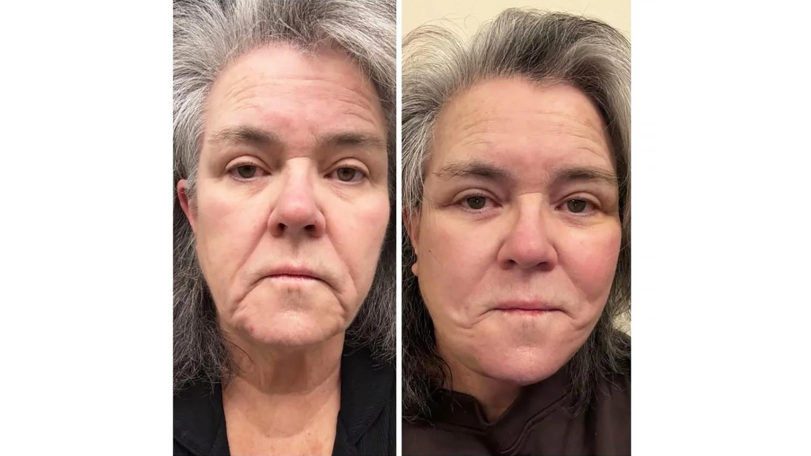 Rosie O’Donnell