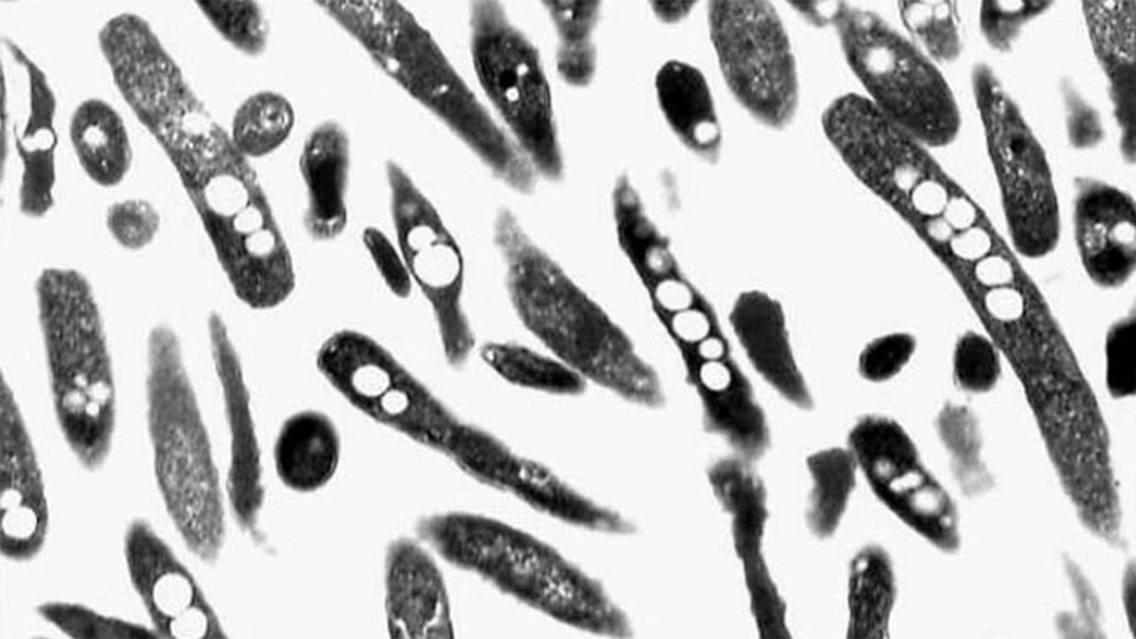 Legionnaires Disease