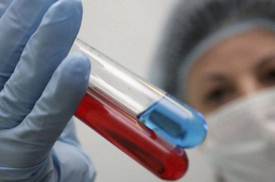 Հայաստանում գրիպի Ա տեսակից մահվան երրորդ դեպքն է գրանցվել