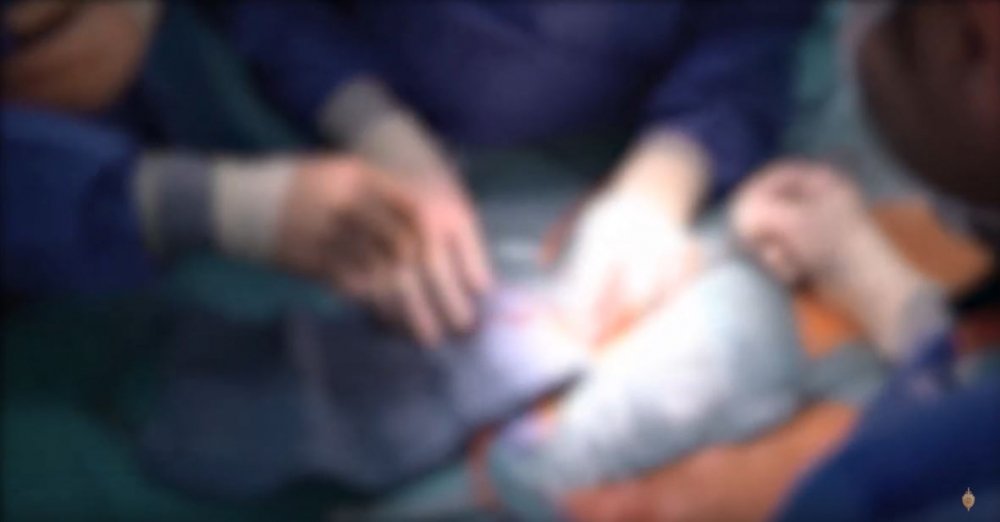 Բացահայտվել է մարդու օրգանի ապօրինի շրջանառության դեպք (ՏԵՍԱՆՅՈւԹ)