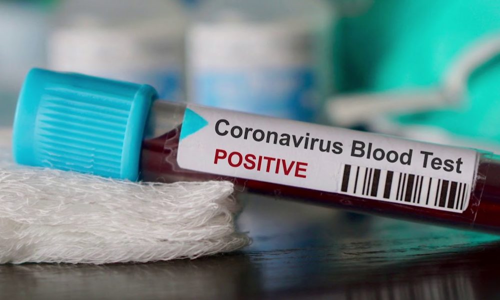 Coronavirus – 1200