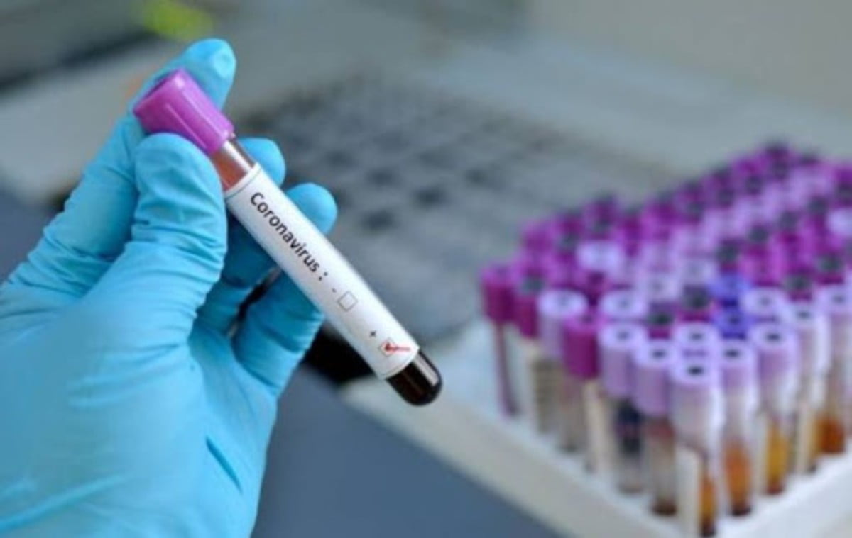 Արցախում ստացվել են թեստավորված 44 փորձանմուշի հետազոտության արդյունքները