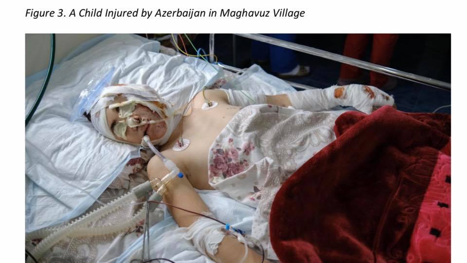 Արցախի բնակչության նկատմամբ Ադրբեջանի վայրագությունները (ԼՈւՍԱՆԿԱՐՆԵՐ)