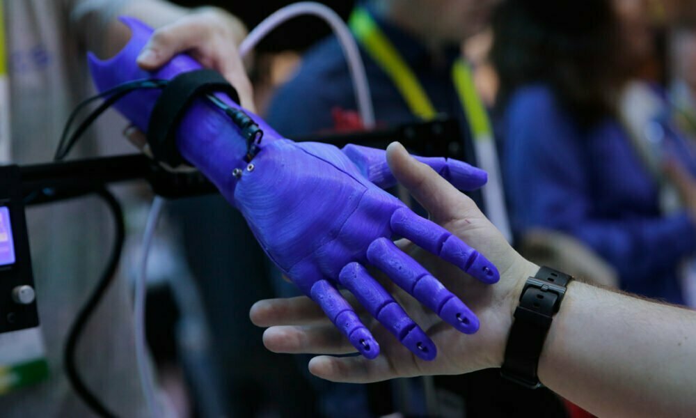 Աջակցող միջոցներ՝ պատերազմի հետևանքով հաշմանդամություն ձեռք բերած անձանց