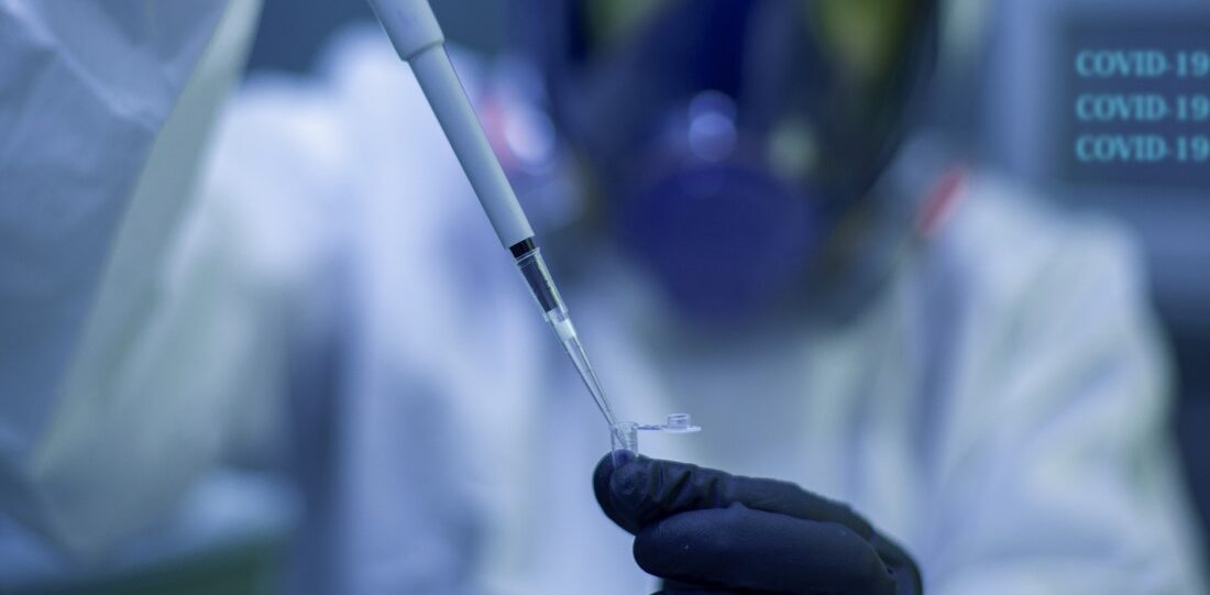 Ուկրաինայում ուսումնասիրվել է չղջիկներից մարդկանց հիվանդությունների փոխանցման եղանակները․ ՌԴ ՊՆ