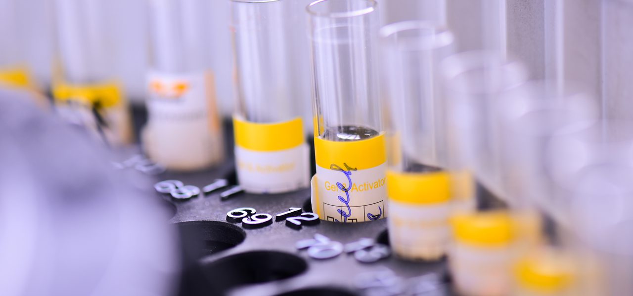 Թուրքիան որոշել է հիմնել ինսուլինի տեղական արտադրություն