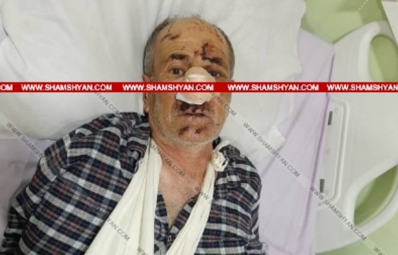 Արջը հարձակվել է բոխի հավաքող տղամարդու վրա. վնասվածքներ է պատճառել գլխին