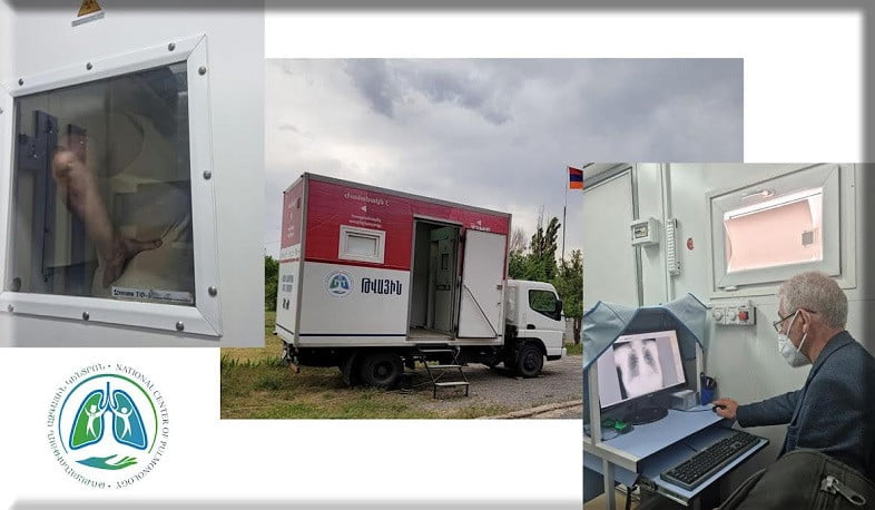 Հոգեկան առողջության պահպանման կենտրոնի պացիենտները հնարավորություն կունենան անցնելու ֆլյուորոգրաֆիկ հետազոտություն