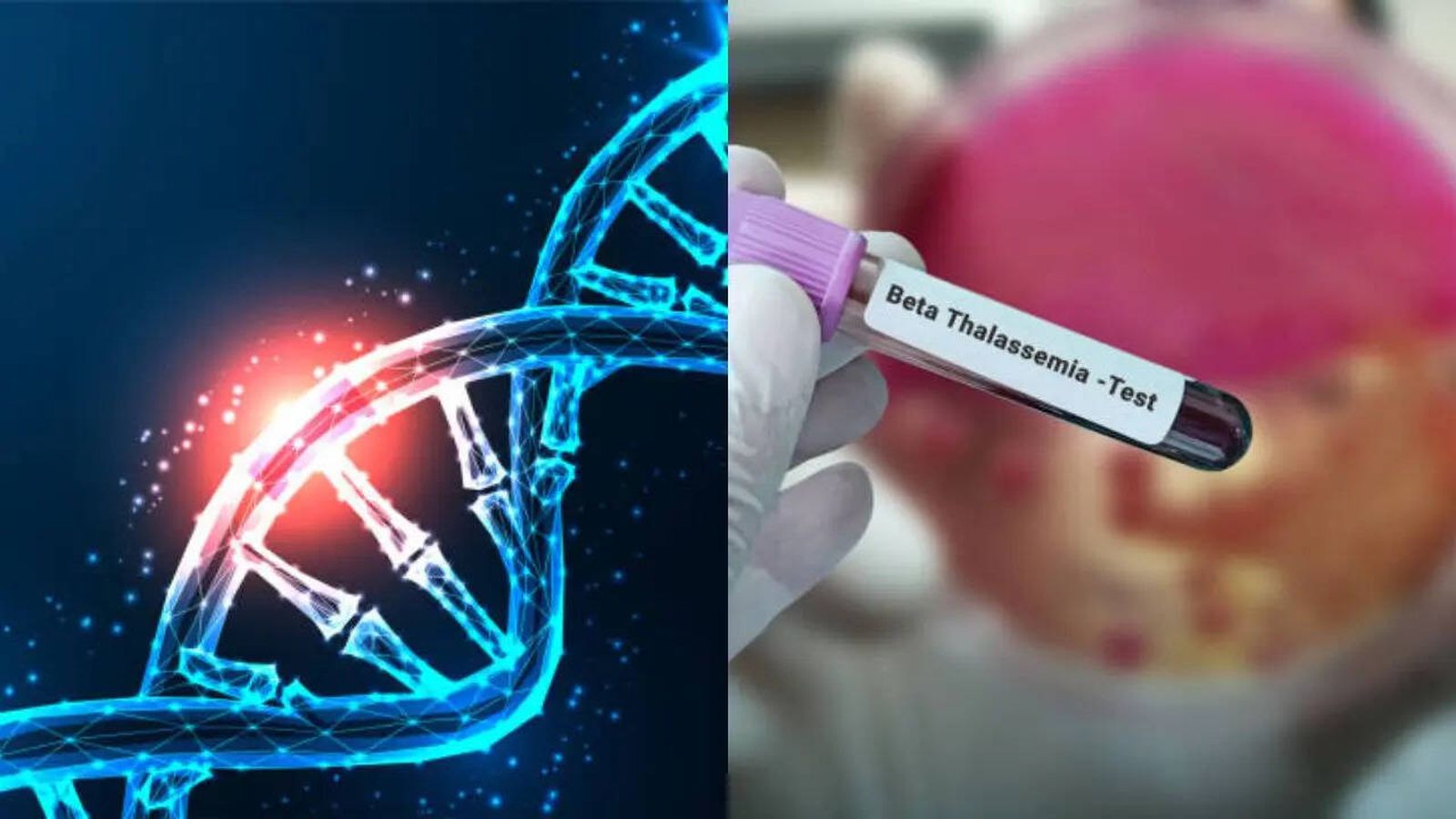 Մեծ Բրիտանիայում NHS-ը բախվեց քննադատության՝ առաջին աստիճանի զարմիկների ամուսնության վերաբերյալ ուղեցույցից հետո