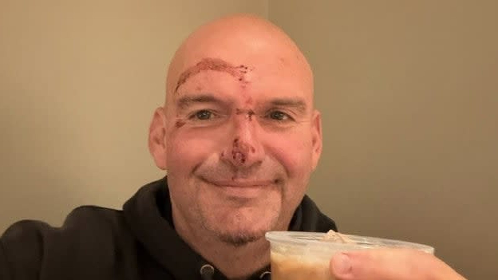 Ջոն Ֆետերմանի առողջական խնդիրները և քաղաքական ուղին․ ինչ է իրականում կատարվում