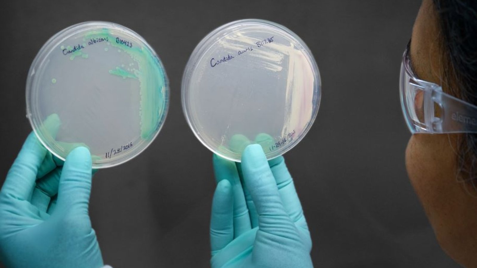 Candida auris microscopic view