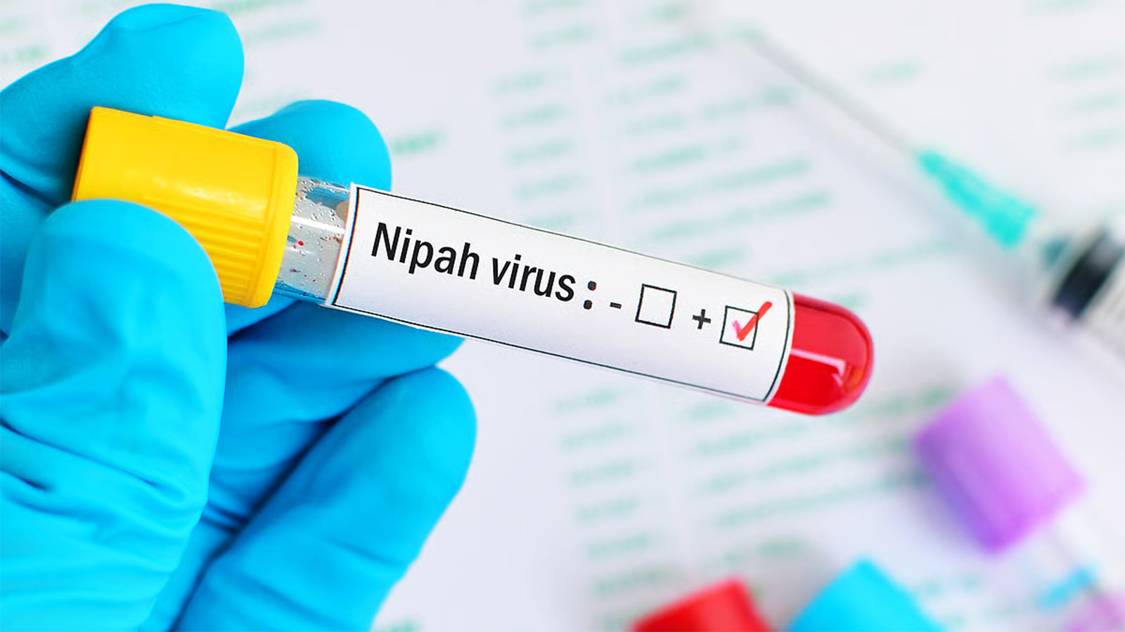 nipah virus test
