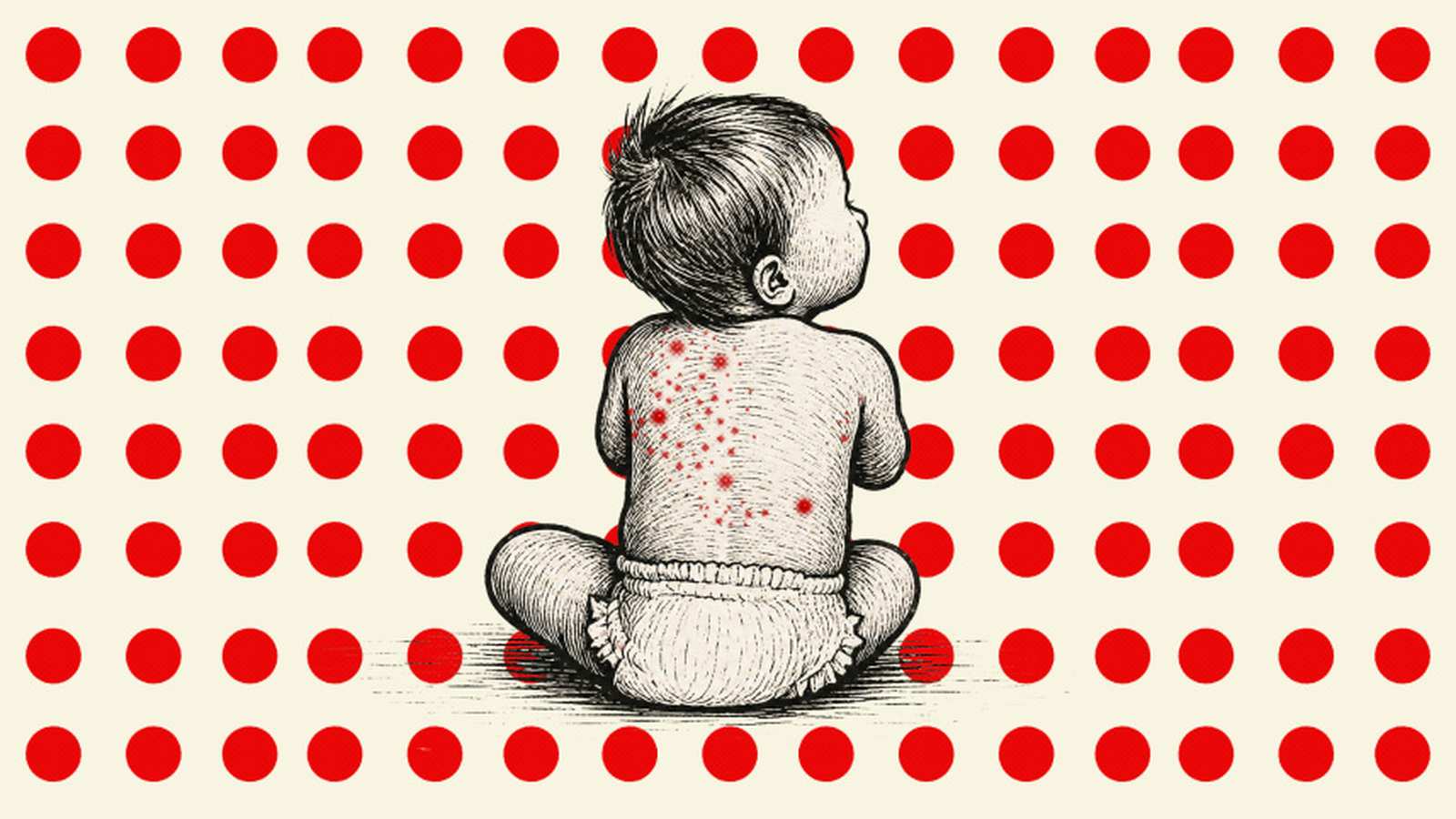 A black and white illustration of a baby sitting with red spots on their back against a red polka do